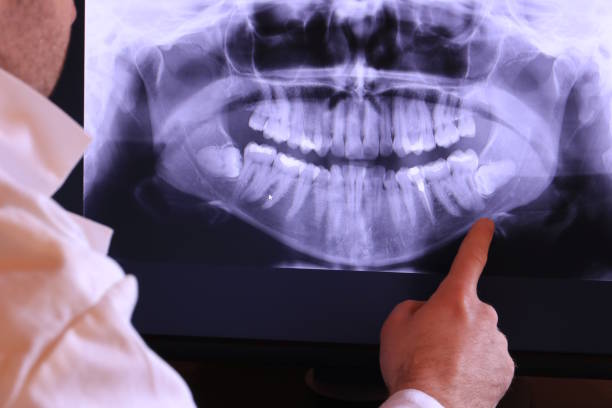 Best Walk-In Emergency Dentist in Silver Creek, NY