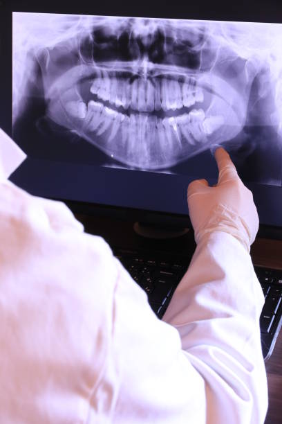 Best Emergency Root Canal Treatment in Silver Creek, NY