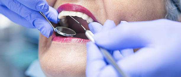 Best Emergency Treatment for Toothache in Silver Creek, NY